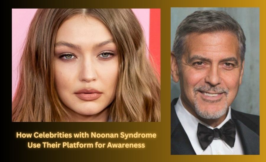 Celebrities with Noonan Syndrome