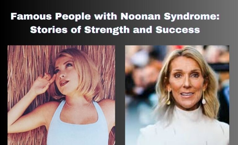 Famous People with Noonan Syndrome